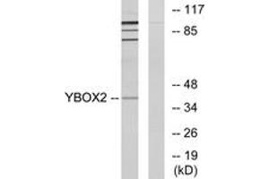 Western blot analysis of extracts from COLO205 cells, using YBOX2 Antibody. (YBX2 Antikörper  (AA 281-330))