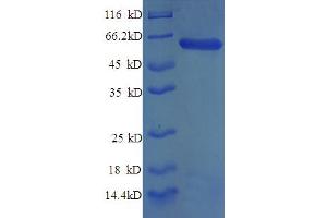 Syntaxin 6 (STX6) (AA 5-234), (partial) protein (GST tag)
