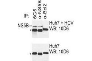 Western Blotting (WB) image for anti-Hepatitis C Virus NS5 (HCV NS5) (AA 77-86) antibody (ABIN781781) (HCV NS5 Antikörper  (AA 77-86))