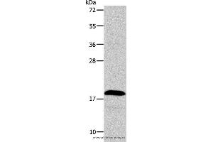 Western blot analysis of Jurkat cell , using TSLP Polyclonal Antibody at dilution of 1:850 (Thymic Stromal Lymphopoietin Antikörper)