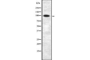 Western Blotting (WB) image for anti-Amyloid beta (A4) Precursor Protein-Binding, Family B, Member 1 Interacting Protein (APBB1IP) (Internal Region) antibody (ABIN6259973)