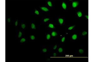 Immunofluorescence of monoclonal antibody to SETX on HeLa cell. (Senataxin (SETX) (AA 2579-2676) Antikörper)