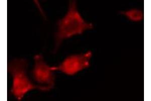 ABIN6269159 staining NIH-3T3 cells by IF/ICC.