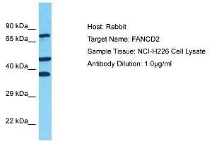 Host: Rabbit Target Name: FANCD2 Sample Type: NCI-H226 Whole Cell lysates Antibody Dilution: 1. (FANCD2 Antikörper  (Middle Region))