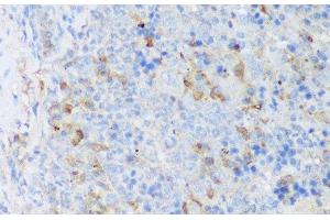 Immunohistochemistry of paraffin-embedded Mouse spleen using CRACR2A Polyclonal Antibody at dilution of 1:150 (40x lens). (EFCAB4B Antikörper)