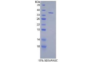 SDS-PAGE (SDS) image for Keratin 71 (KRT71) (AA 132-440) protein (His tag) (ABIN1080164) (Keratin 71 Protein (KRT71) (AA 132-440) (His tag))