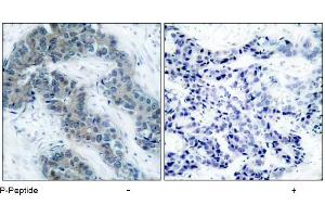 Image no. 1 for anti-Janus Kinase 2 (JAK2) (pTyr1007) antibody (ABIN196873) (JAK2 Antikörper  (pTyr1007))