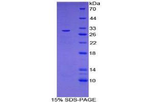 SDS-PAGE analysis of Mouse IL27Ra Protein. (IL27 Receptor alpha Protein)