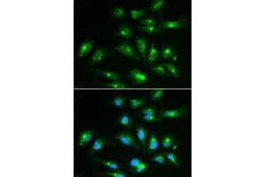 Immunofluorescence analysis of HepG2 cell using CD46 antibody. (CD46 Antikörper  (AA 40-320))