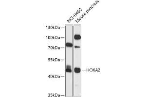 Western blot analysis of extracts of various cell lines, using HOX antibody (ABIN6128061, ABIN6141938, ABIN6141939 and ABIN6225060) at 1:1000 dilution. (HOXA2 Antikörper  (AA 207-376))