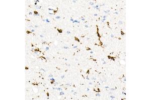 Immunohistochemistry of paraffin-embedded Human brain using CD74 antibody (ABIN7267759) at dilution of 1:100 (40x lens). (CD74 Antikörper)