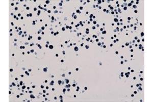 ICC staining of human HepG2 cells with recombinant H3K56ac antibody. (Rekombinanter Histone 3 Antikörper  (H3K56ac))