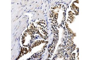 IHC analysis of NOLA1/GAR1 using anti-NOLA1/GAR1 antibody (ABIN7602076). (GAR1 Antikörper  (AA 58-165))