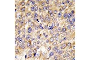 Immunohistochemistry (IHC) image for anti-GABA(A) Receptor-Associated Protein (GABARAP) (AA 1-30) antibody (ABIN3031014)