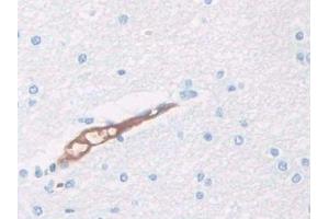 DAB staining on IHC-P; Samples: Human Cerebrum Tissue (HPR Antikörper  (AA 30-85))