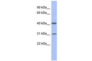 Image no. 1 for anti-Glyceraldehyde-3-Phosphate Dehydrogenase, Spermatogenic (GAPDHS) (AA 107-156) antibody (ABIN6742954) (GAPDHS Antikörper  (AA 107-156))