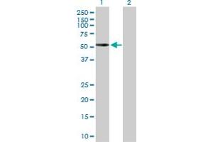 Western Blot analysis of PRKACA expression in transfected 293T cell line by PRKACA MaxPab polyclonal antibody.