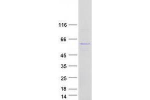 Validation with Western Blot (UBXN6 Protein (Myc-DYKDDDDK Tag))