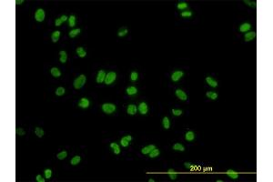 Immunofluorescence of monoclonal antibody to DDX41 on HeLa cell. (DDX41 Antikörper  (AA 523-622))