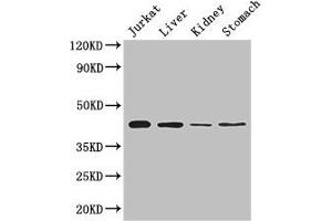 Western Blot Positive WB detected in: Jurkat whole cell lysate, Mouse liver tissue, Mouse kidney tissue, Mouse stomach tissue All lanes: Hoxa2 antibody at 2 μg/mL Secondary Goat polyclonal to rabbit IgG at 1/50000 dilution Predicted band size: 42 kDa Observed band size: 42 kDa (HOXA2 Antikörper  (AA 26-124))