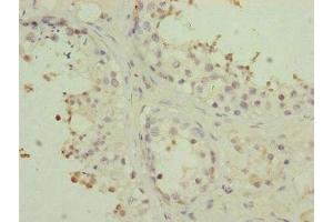 Immunohistochemistry of paraffin-embedded human testis tissue using ABIN7159960 at dilution of 1:100 (PMPCB Antikörper  (AA 110-380))