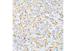 Immunohistochemistry of paraffin-embedded rat ovary using Sec23AA Rabbit mAb (ABIN7270168) at dilution of 1:100 (40x lens). (SEC23A Antikörper)