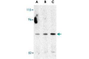 Western blot analysis of ATG7 in Caco-2 cell lysate with ATG7 polyclonal antibody  at (A) 0. (ATG7 Antikörper  (C-Term))