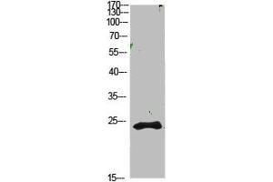 Western Blot analysis of 1,mouse-kidney cells using primary antibody diluted at 1:1000(4 °C overnight). (Cardiotrophin 1 Antikörper  (AA 151-200))