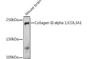 Western blot analysis of extracts of Mouse brain, using Collagen III alpha 1/COL3 Rabbit pAb (ABIN1679317, ABIN3018108, ABIN3018109 and ABIN6220366) at 1:1000 dilution. (COL3A1 Antikörper  (AA 1217-1466))