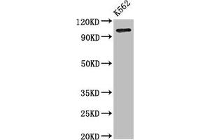 Western Blot Positive WB detected in: K562 whole cell lysate All lanes: ERAP1 antibody at 3. (ERAP1 Antikörper  (AA 642-941))
