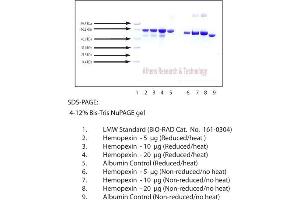 Gel Scan of Hemopexin, Human Plasma  This information is representative of the product ART prepares, but is not lot specific. (Hemopexin Protein (HPX))