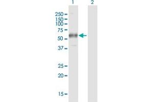 Western Blotting (WB) image for anti-Fc Fragment of IgG, High Affinity Ia, Receptor (CD64) (FCGR1A) (AA 1-374) antibody (ABIN515559)