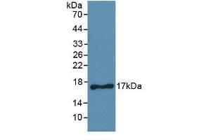 Detection of Recombinant CD40L, Human using Monoclonal Antibody to Cluster Of Differentiation 40 Ligand (CD40L) (CD40 Ligand Antikörper  (AA 180-261))