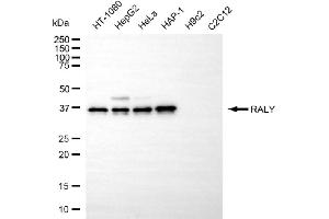 Western blotting analysis using RALY antibody (ABIN7800263).