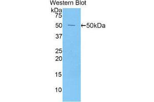 Western Blotting (WB) image for anti-Peroxiredoxin 1 (PRDX1) (AA 1-199) antibody (ABIN1860301) (Peroxiredoxin 1 Antikörper  (AA 1-199))