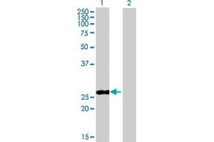 Western Blot analysis of PPP2R3B expression in transfected 293T cell line by PPP2R3B MaxPab polyclonal antibody. (PPP2R3B Antikörper  (AA 1-176))