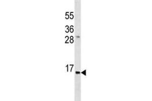 Anti-Insulin antibody western blot analysis in ZR-75-1 lysate. (Insulin Antikörper  (AA 35-64))