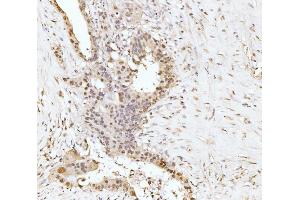 IHC analysis of RRP4/EXOSC2 using anti-RRP4/EXOSC2 antibody (ABIN7602188). (EXOSC2 Antikörper  (AA 62-293))