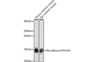 Western blot analysis of extracts of various cell lines, using Parvalbumin (PVALB) antibody (ABIN3016700, ABIN3016701, ABIN3016702 and ABIN6219820) at 1:1000 dilution. (PVALB Antikörper)