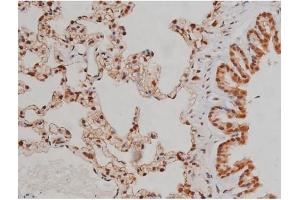 Immunohistochemistry (IHC) image for anti-Insulin-Like Growth Factor 1 Receptor (IGF1R) (pTyr1346) antibody (ABIN6256637)