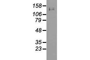 Western blot analysis of 35 µg of cell extracts from human Liver carcinoma (HepG2) cells using anti-L1CAM antibody.