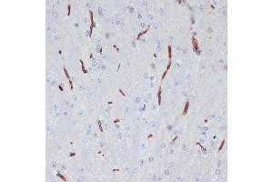 Immunohistochemistry of paraffin-embedded mouse brain using  antibody (ABIN6129926, ABIN6136997, ABIN6136998 and ABIN6218500) at dilution of 1:100 (40x lens). (APOA1 Antikörper  (AA 25-267))