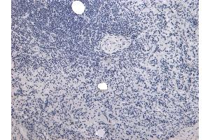 (ABIN190847) Negative Control showing staining of paraffin embedded Human Spleen, with no primary antibody. (P4HA1 Antikörper  (Internal Region))