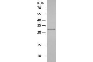 Western Blotting (WB) image for TAF15 RNA Polymerase II, TATA Box Binding Protein (TBP)-Associated Factor, 68kDa (TAF15) (AA 148-406) protein (His tag) (ABIN7125313) (TAF15 Protein (AA 148-406) (His tag))