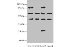 Western blot All lanes: FLVCR2 antibody at 0. (FLVCR2 Antikörper  (AA 1-100))