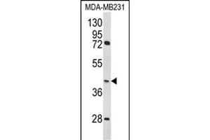 Western blot analysis of HOMER3 Antibody (Center) (ABIN652274 and ABIN2841157) in MDA-M cell line lysates (35 μg/lane). (HOMER3 Antikörper  (AA 281-308))