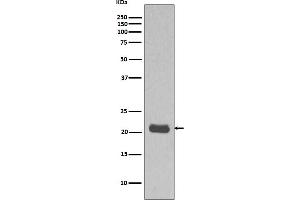 Western blot analysis MCF7 cell lysate using HRAS Antibody.