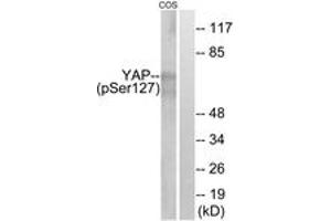 Western blot analysis of extracts from COS7 cells treated with HU 2nM 24h, using YAP (Phospho-Ser127) Antibody. (YAP1 Antikörper  (pSer127))