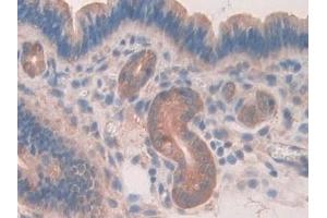 Immunohistochemistry (IHC) image for anti-Caspase Recruitment Domain Family, Member 9 (CARD9) (AA 274-530) antibody (ABIN7439921)