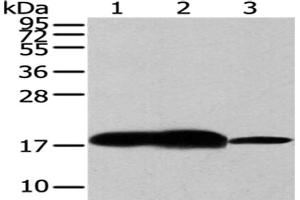 Gel: 12 % SDS-PAGE,Lysate: 40 μg,Lane 1-3: Human fetal brain tissue, Mouse brain tissue, Hela cells,Primary antibody: ABIN7193008(VAMP2 Antibody) at dilution 1/200 dilution,Secondary antibody: Goat anti rabbit IgG at 1/8000 dilution,Exposure time: 30 seconds (VAMP2 Antikörper)